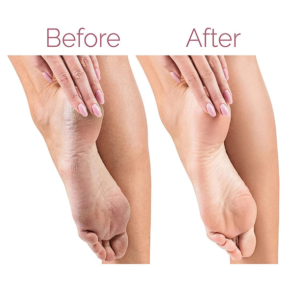 Rechargeable Electric Foot File: Callus Remover & Pedicure Tool